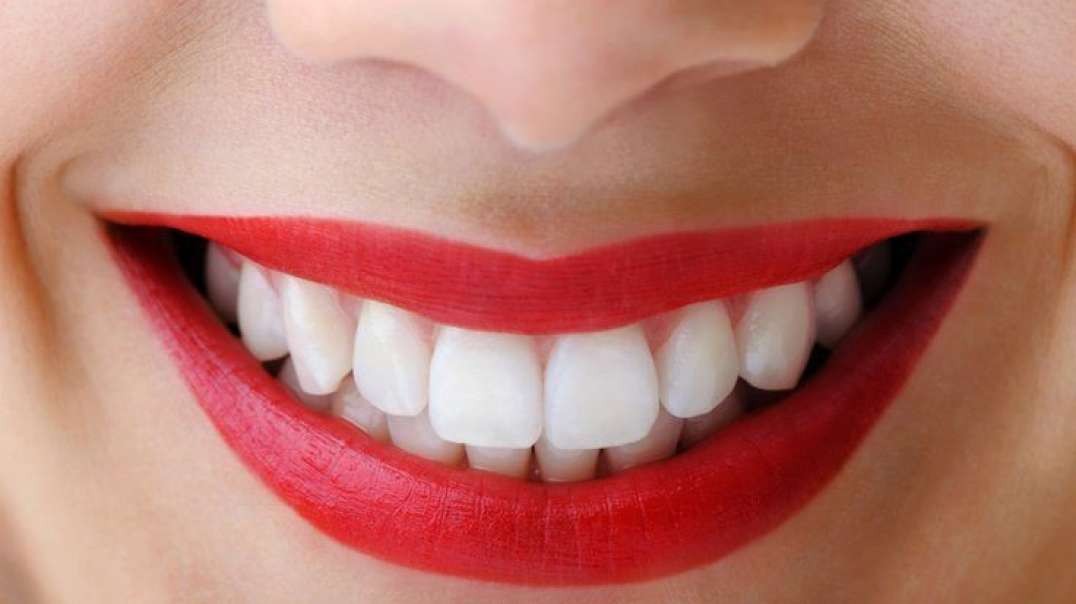 Miami Dental Group - Teeth Whitening in West Kendall, FL
