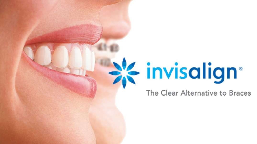 Lujan Dental : Clear Braces in Tamiami, FL : (305) 480-8353