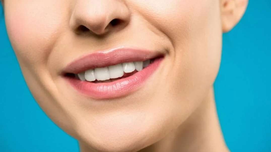 MSG Dental : Teeth Whitening in Hialeah Gardens, FL