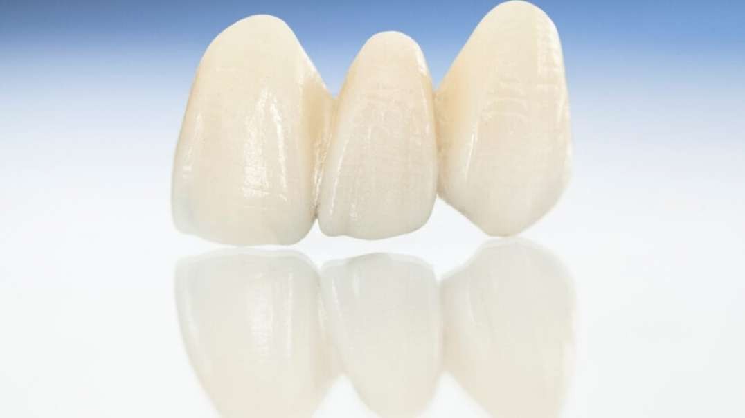 Advanced Dental Solutions : Dental Crown in Sunset