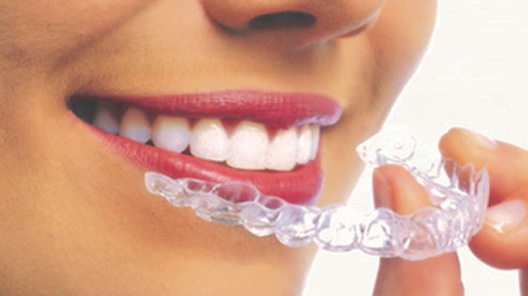 Mancia Orthodontics : #1 Invisalign Braces in Miami, FL | 305-559-5571