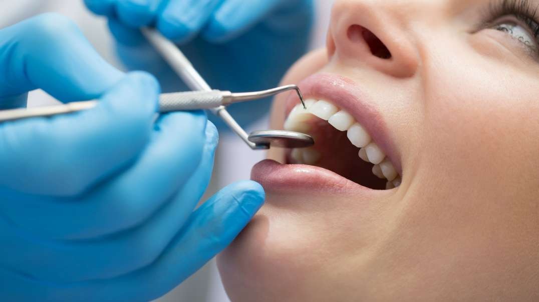 Rielo Dental Clinic : #1 Dental Veneers in Hialeah, FL | 33012