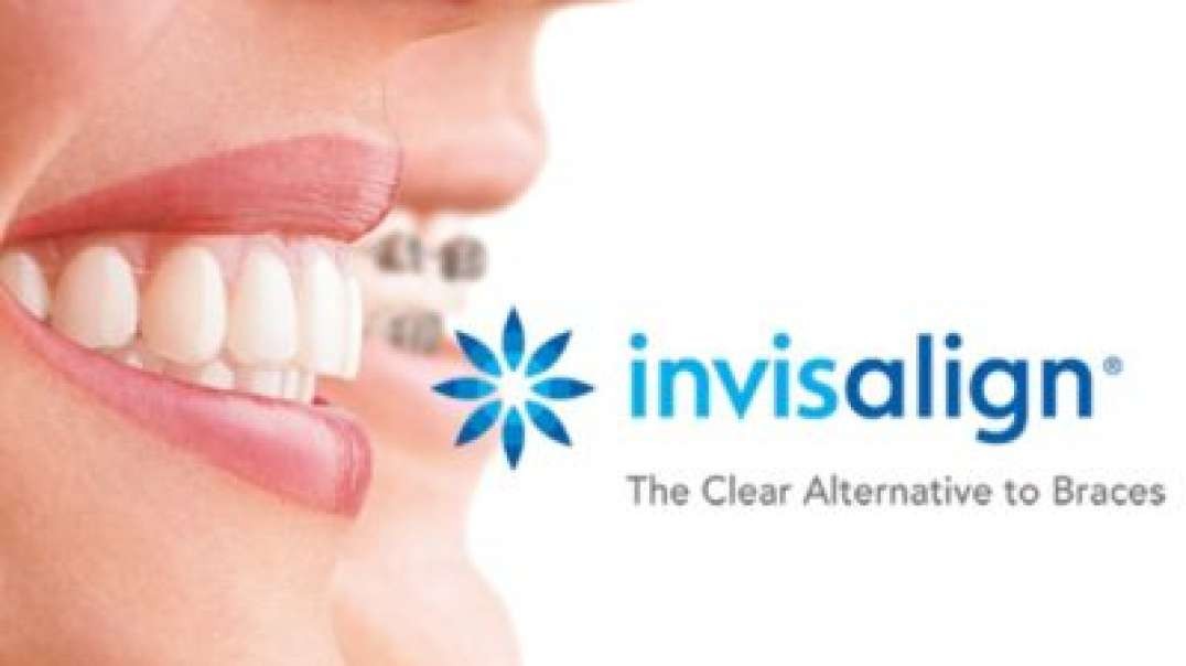 Miami Lakes Dental Health Center : Best Invisalign in Miami Lakes, FL