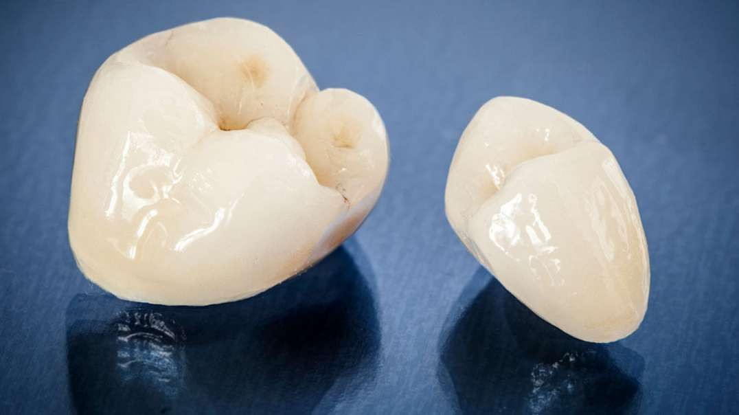 Advanced Dentistry of Coral Springs : Dental Crown in Coral Springs, FL | 33071