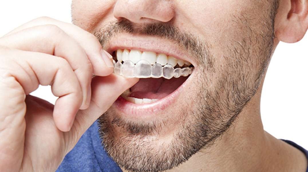 Floridian Dental Group : Best Invisalign in West Kendall, FL